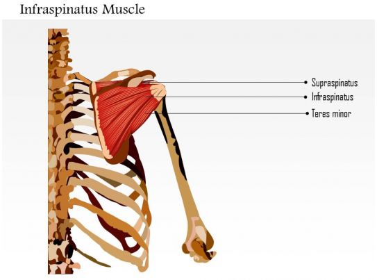 0914_infraspinatus_muscle_medical_images_for_powerpoint_Slide01