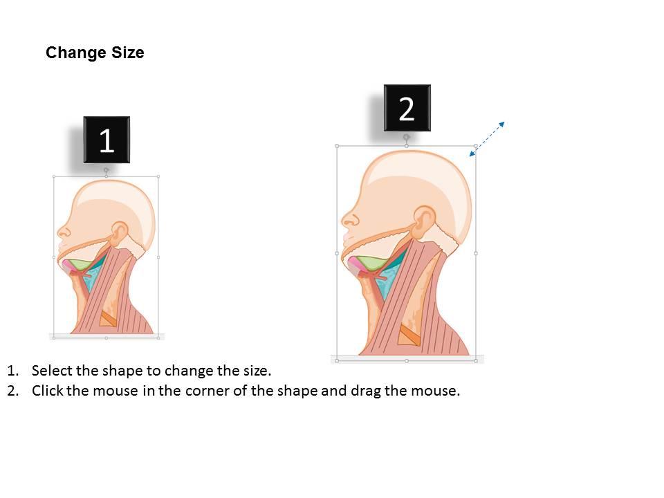 0514 Anatomical Triangles Of Neck Medical Images For PowerPoint