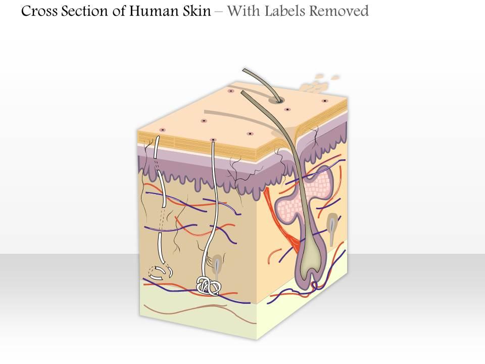 0614 cross section of human skin Medical Images For ...