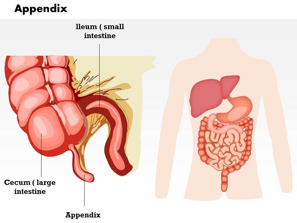 0714 appendix medical images for powerpoint Slide01