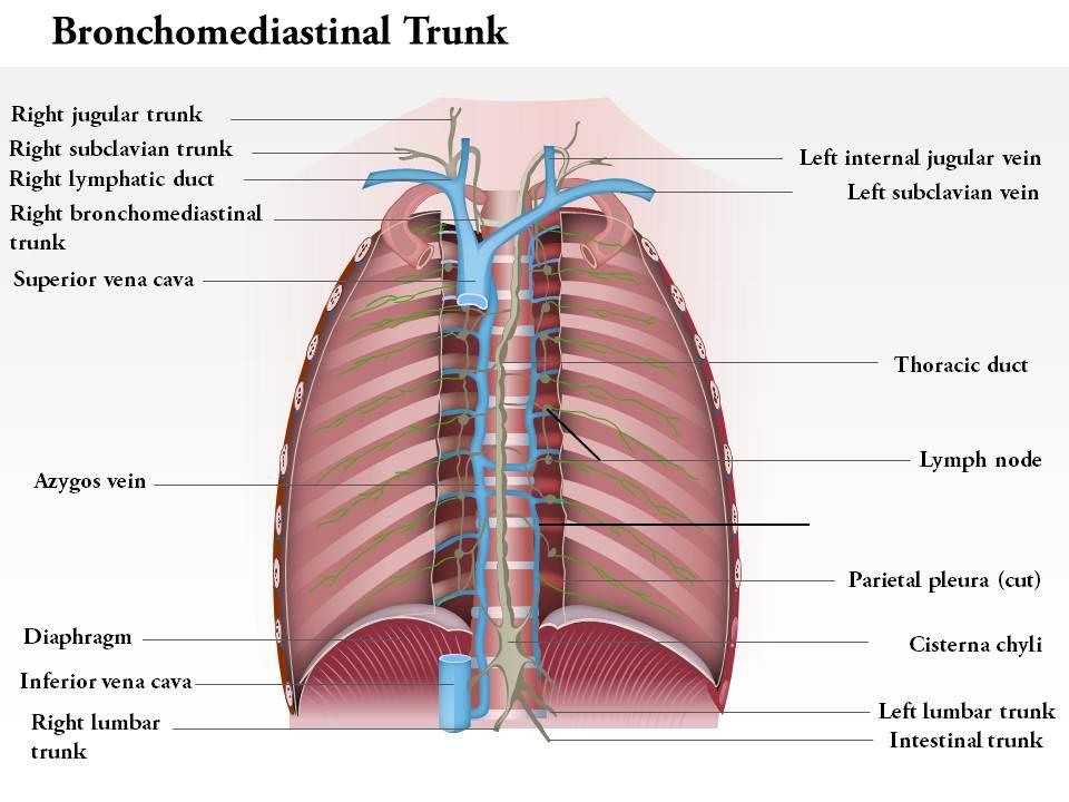 0714 bronchomediastinal trunk medical images for powerpoint Slide00