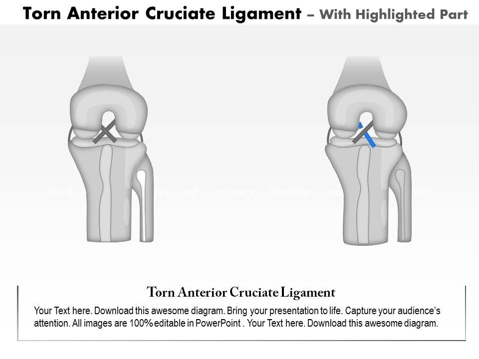 Top 10 Acls PowerPoint Presentation Templates in 2026