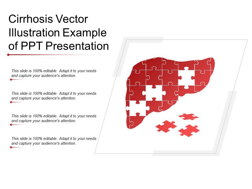 cirrhosis_vector_illustration_example_of_ppt_presentation_Slide01