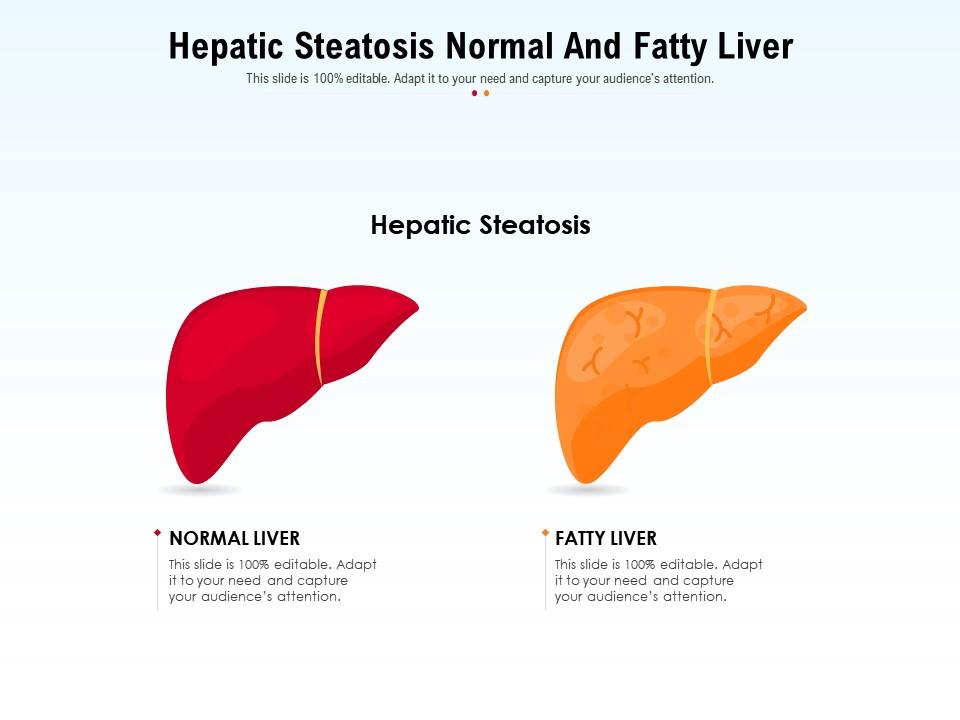 Hepatic steatosis normal and fatty liver