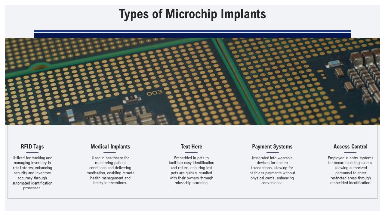 Types Of Microchip Implants Microchip Implants PPT Sample ST AI SS PPT