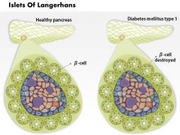 plantillas de powerpoint para diabetes mellitus