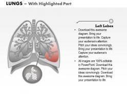 0514 anatomy of human lungs medical images for powerpoint