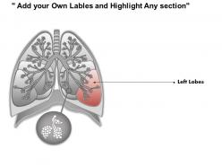 0514 anatomy of human lungs medical images for powerpoint