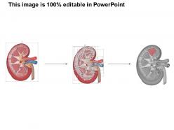 0514 anatomy of kidney medical images for powerpoint 1