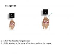 0514 anatomy of seif knee medical images for powerpoint