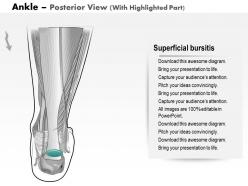 0514 ankle posterior medical images for powerpoint