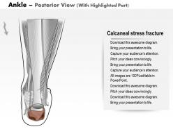 0514 ankle posterior medical images for powerpoint