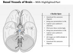 0514 basal vessels of the brain medical images for powerpoint