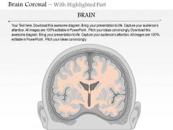 0514 brain coronal medical images for powerpoint