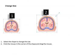 0514 brain coronal medical images for powerpoint