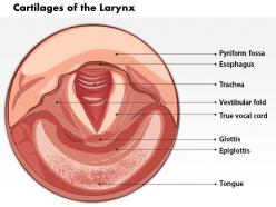 0514 cartilages of the larynx medical images for powerpoint