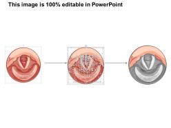 0514 cartilages of the larynx medical images for powerpoint