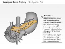 0514 duodenum human anatomy medical images for powerpoint