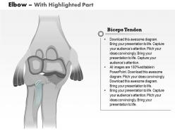 0514 elbow anterior view medical images for powerpoint