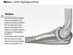 0514 elbow lateral medical images for powerpoint