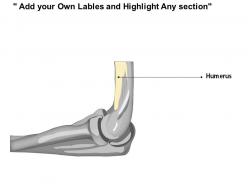 0514 elbow lateral medical images for powerpoint