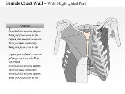 0514 female chest wall anterior view medical images for powerpoint