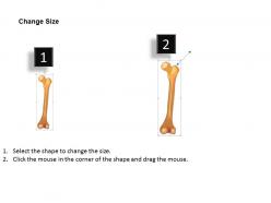 0514 femur posterior view medical images for powerpoint