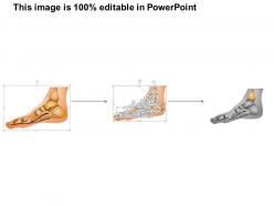 12116199 style medical 1 musculoskeletal 1 piece powerpoint presentation diagram infographic slide