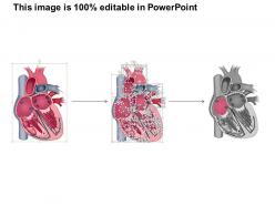 0514 heart anatomy medical images for powerpoint