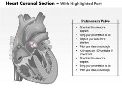 0514 heart coronal section medical images for powerpoint