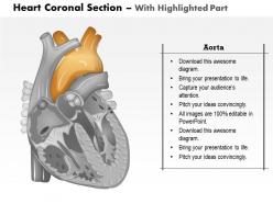 0514 heart coronal section medical images for powerpoint