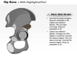 0514 hip bone lateral view medical images for powerpoint
