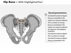 0514 hip bone medical images for powerpoint