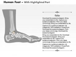 0514 human foot medical images for powerpoint