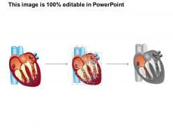 0514 human heart medical images for powerpoint