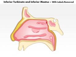 0514 inferior turbinate and inferior meatus