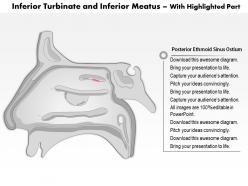 0514 inferior turbinate and inferior meatus