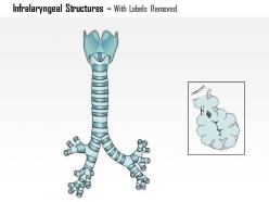 0514 infralaryngeal structures respiratory tree medical images for powerpoint