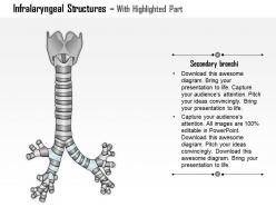 0514 infralaryngeal structures respiratory tree medical images for powerpoint