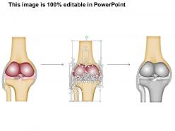0514 knee anterior view medical images for powerpoint