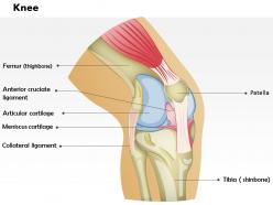 0514 knee medical images for powerpoint