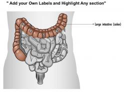 0514 large intestine medical images for powerpoint