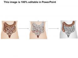 0514 large intestine medical images for powerpoint