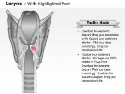 0514 larynx medical images for powerpoint
