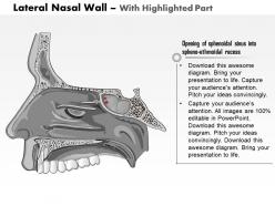0514 lateral nasal wall medical images for powerpoint