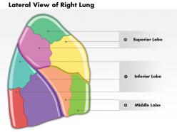 0514 lateral view of right lung human anatomy medical images for powerpoint
