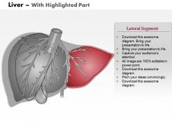 0514 liver medical images for powerpoint
