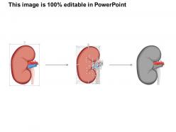 0514 location of right kidney medical images for powerpoint