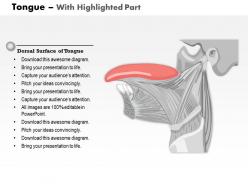 31083154 style medical 1 musculoskeletal 1 piece powerpoint presentation diagram infographic slide