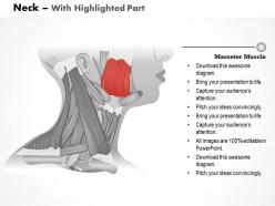 0514 neck medical images for powerpoint